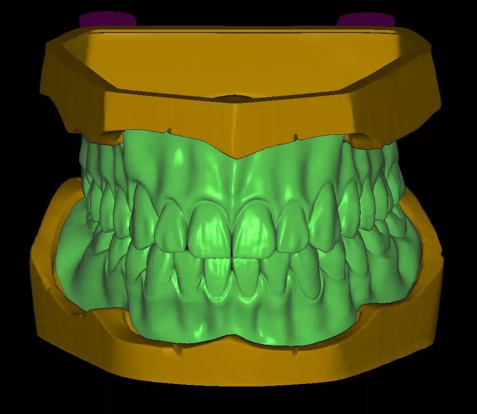 Complete Denture Set Free 3D print model