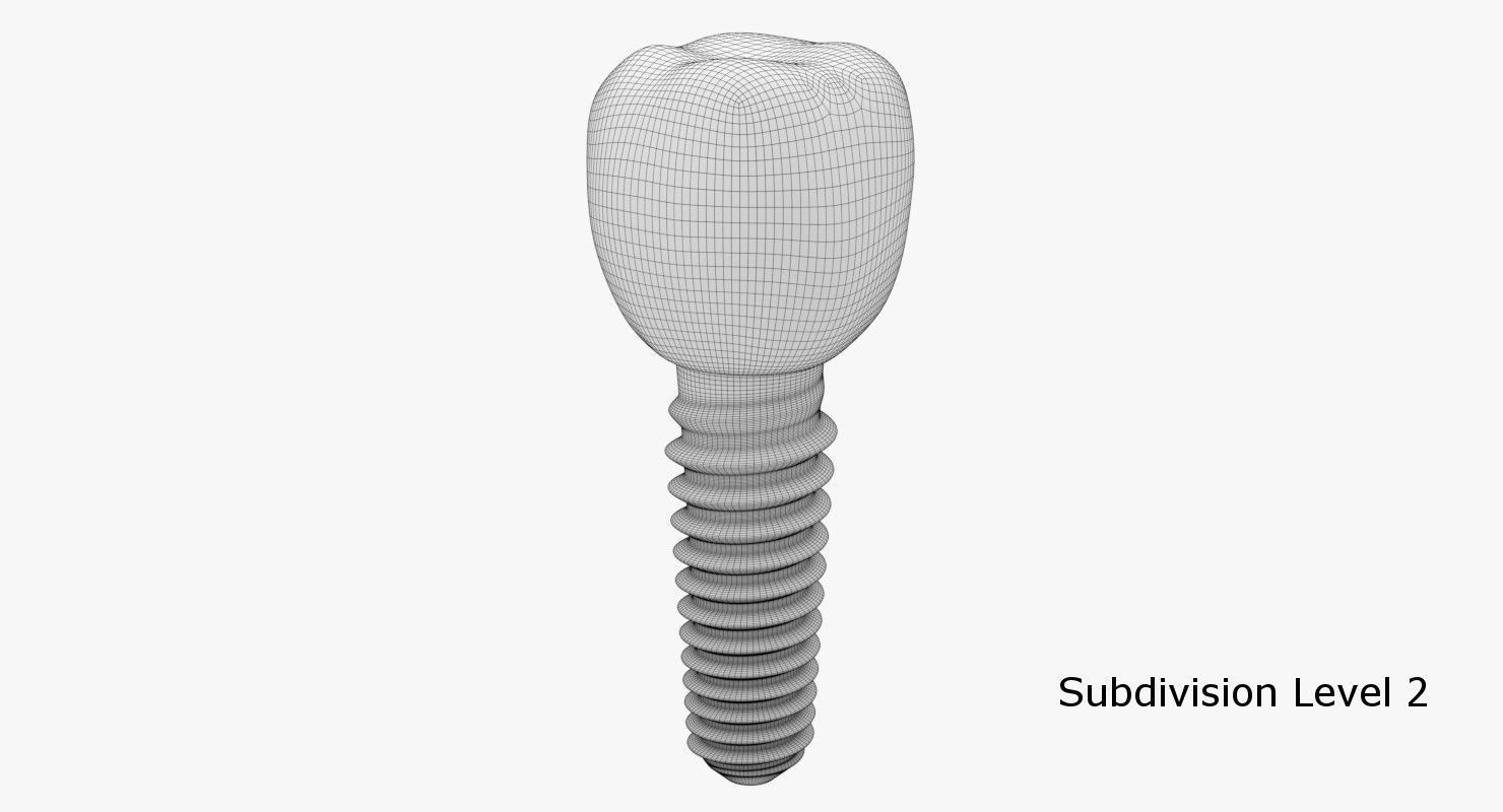 Tooth Implant 3D model_6