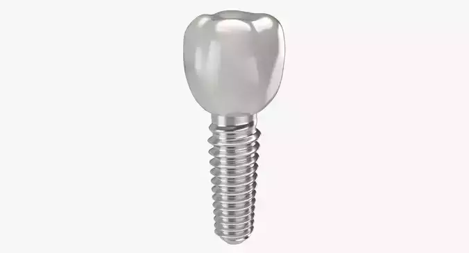 Tooth Implant 3D model