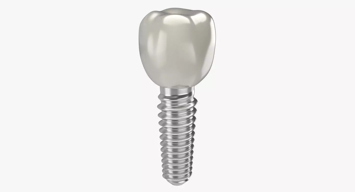 Tooth Implant 3D model_0