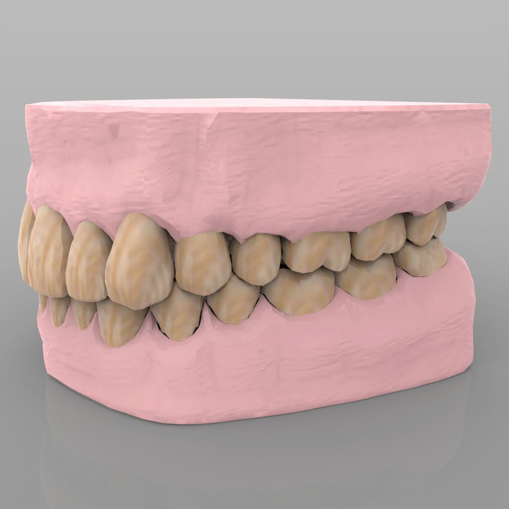 Teeth 2 with Gums and Texture 3D model_2