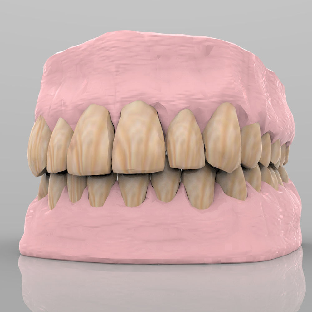 Teeth 2 with Gums and Texture 3D model_1