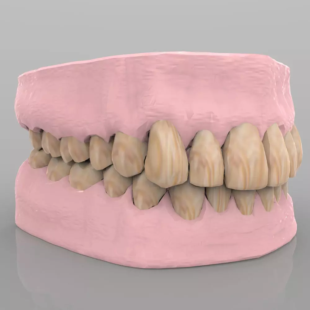 Teeth 2 with Gums and Texture 3D model_0