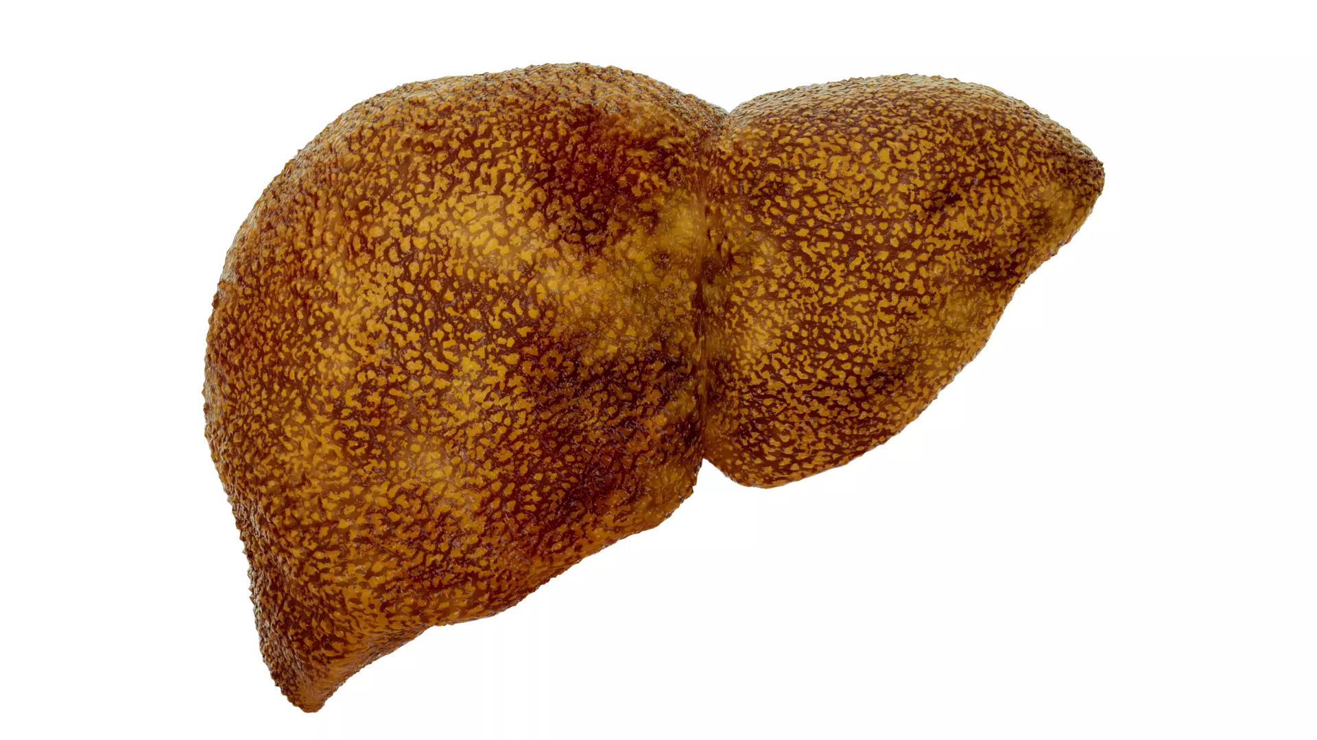 Cirrhosis liver disease digestive system organs 3D model