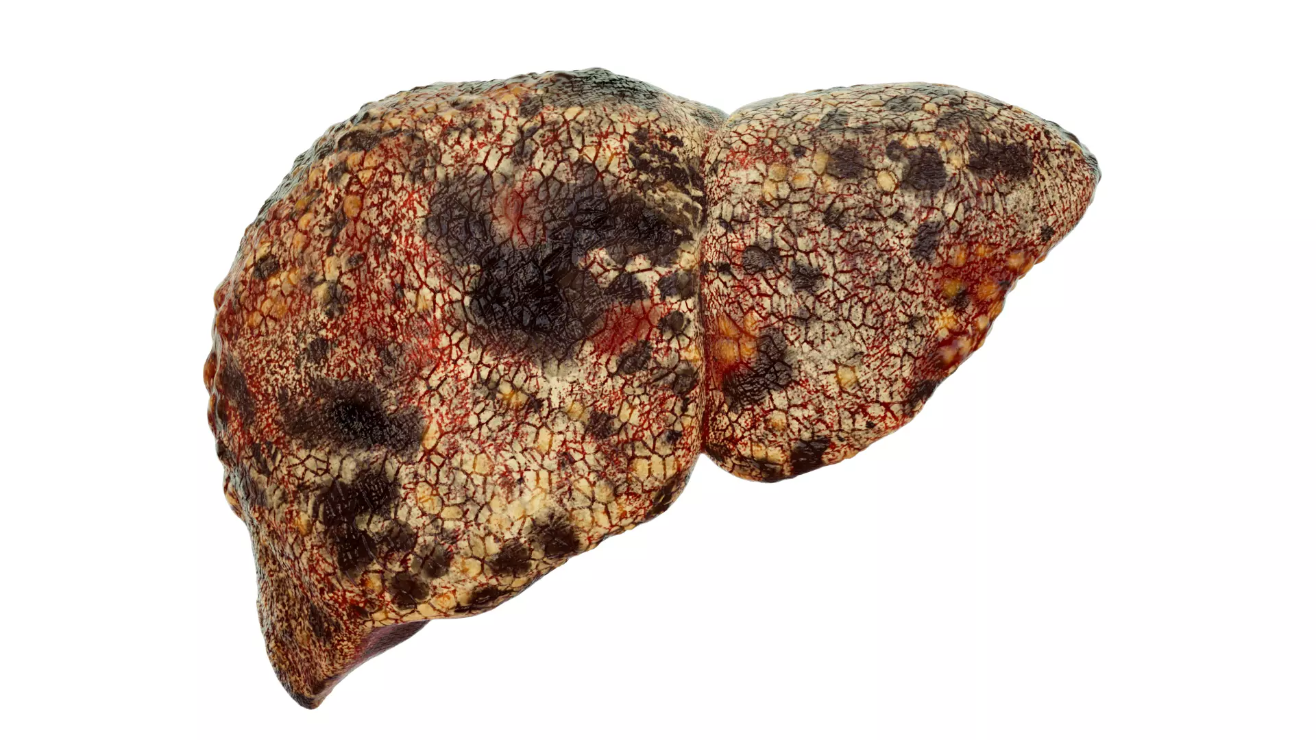 Liver cancer liver disease digestive system organs 3D model