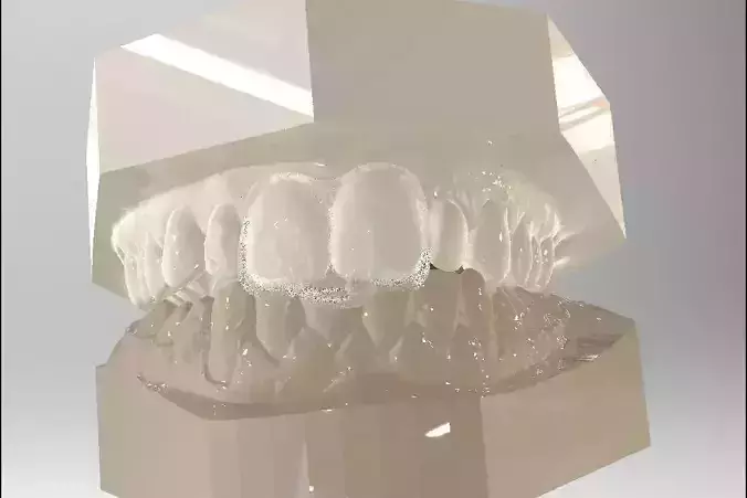 Digital Dental NTI Splint  3D print model
