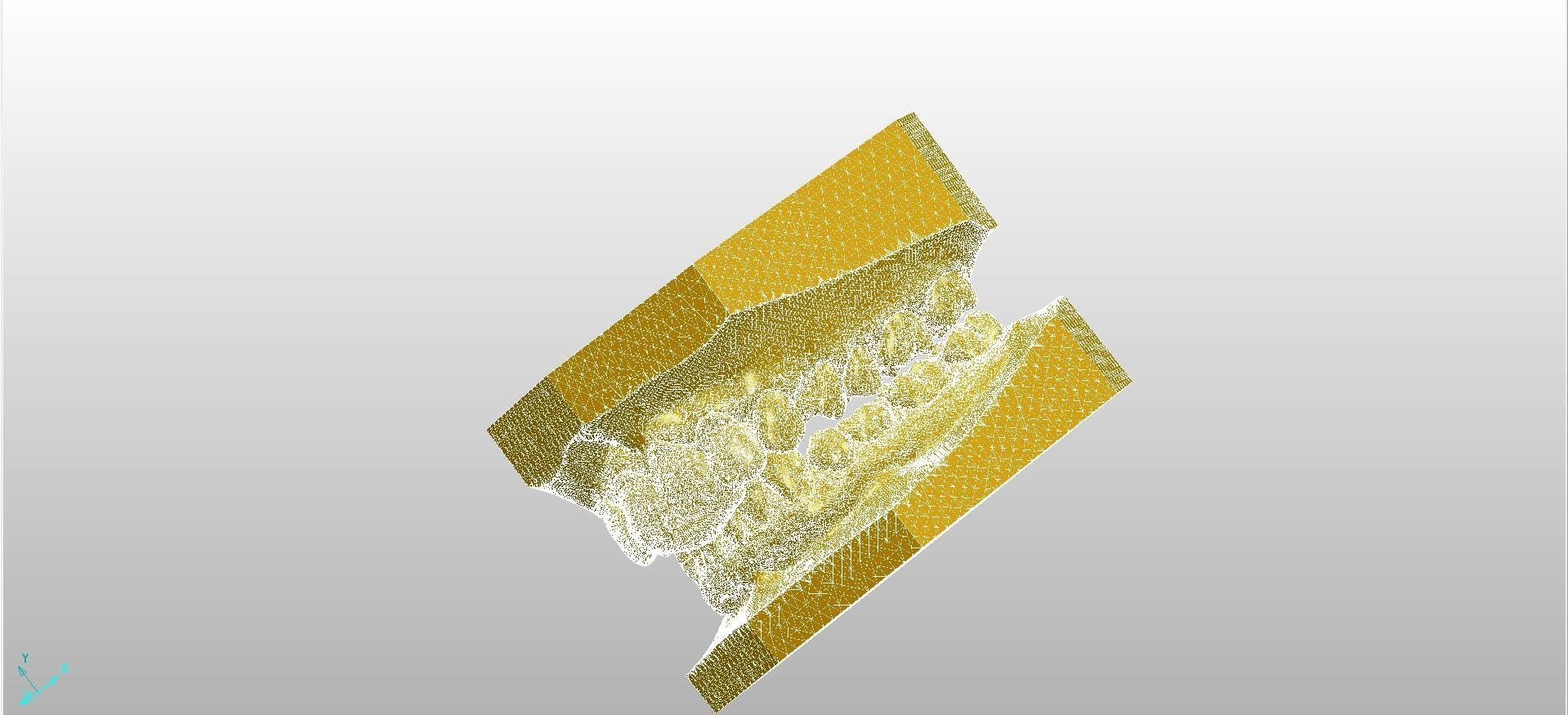 Digital Dental NTI Splint  3D print model_3