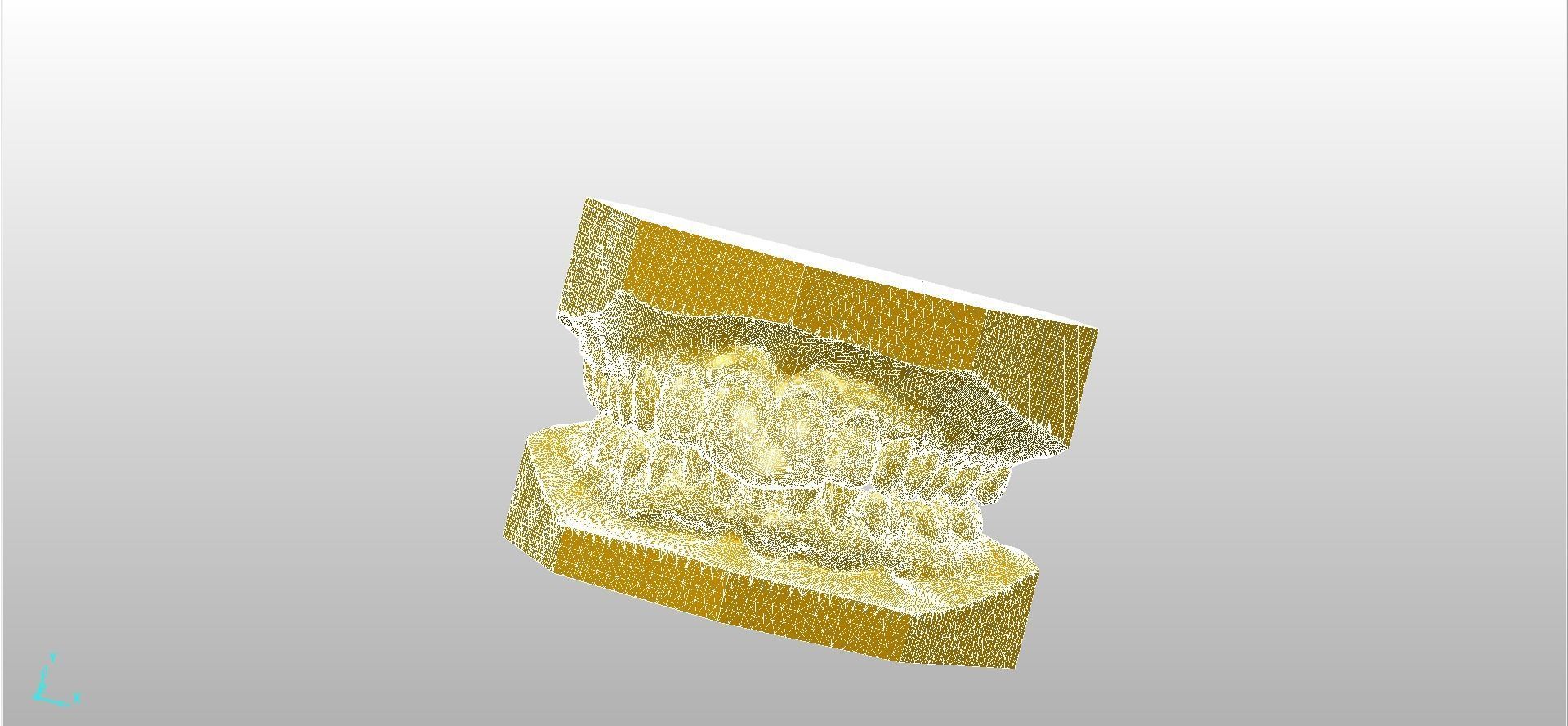 Digital Dental NTI Splint  3D print model_2