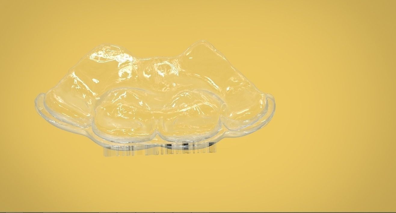 Digital Dental NTI Splint  3D print model_5