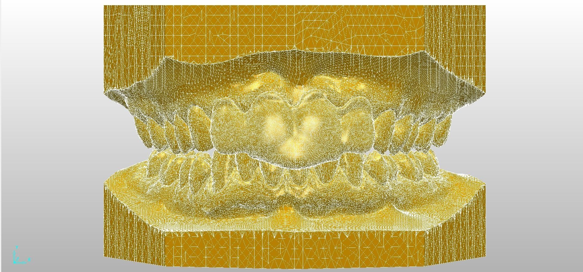 Digital Dental NTI Splint  3D print model_4
