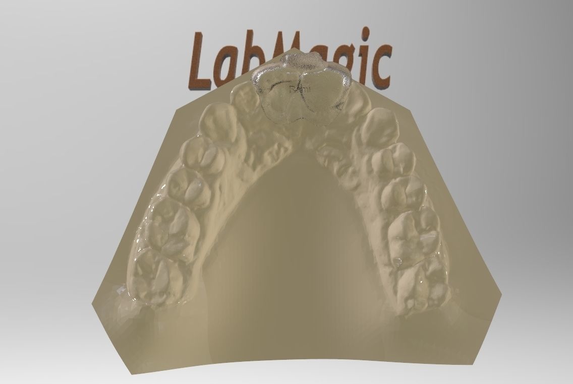 Digital Dental NTI Splint  3D print model_8