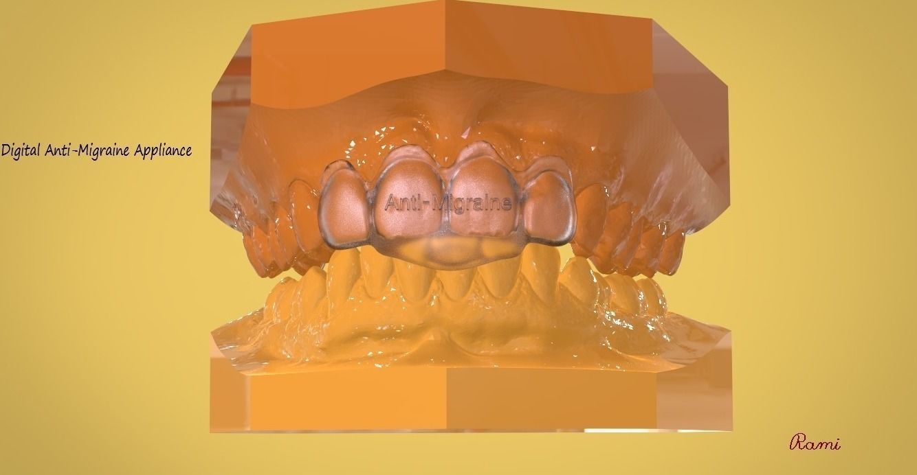 Digital Dental NTI Splint  3D print model_1