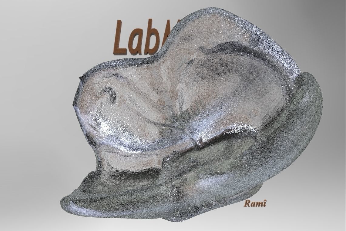 Digital Dental NTI Splint  3D print model_11