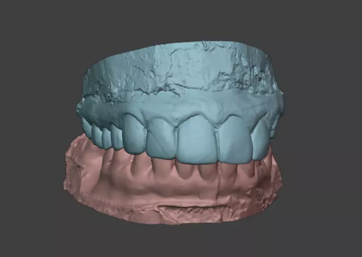 Dental Prosthesis UP2 3D print model