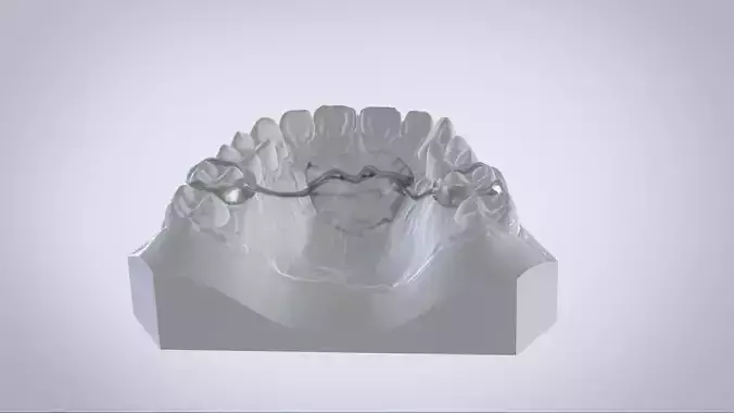 Digital Nance Holder Appliance 3D print model