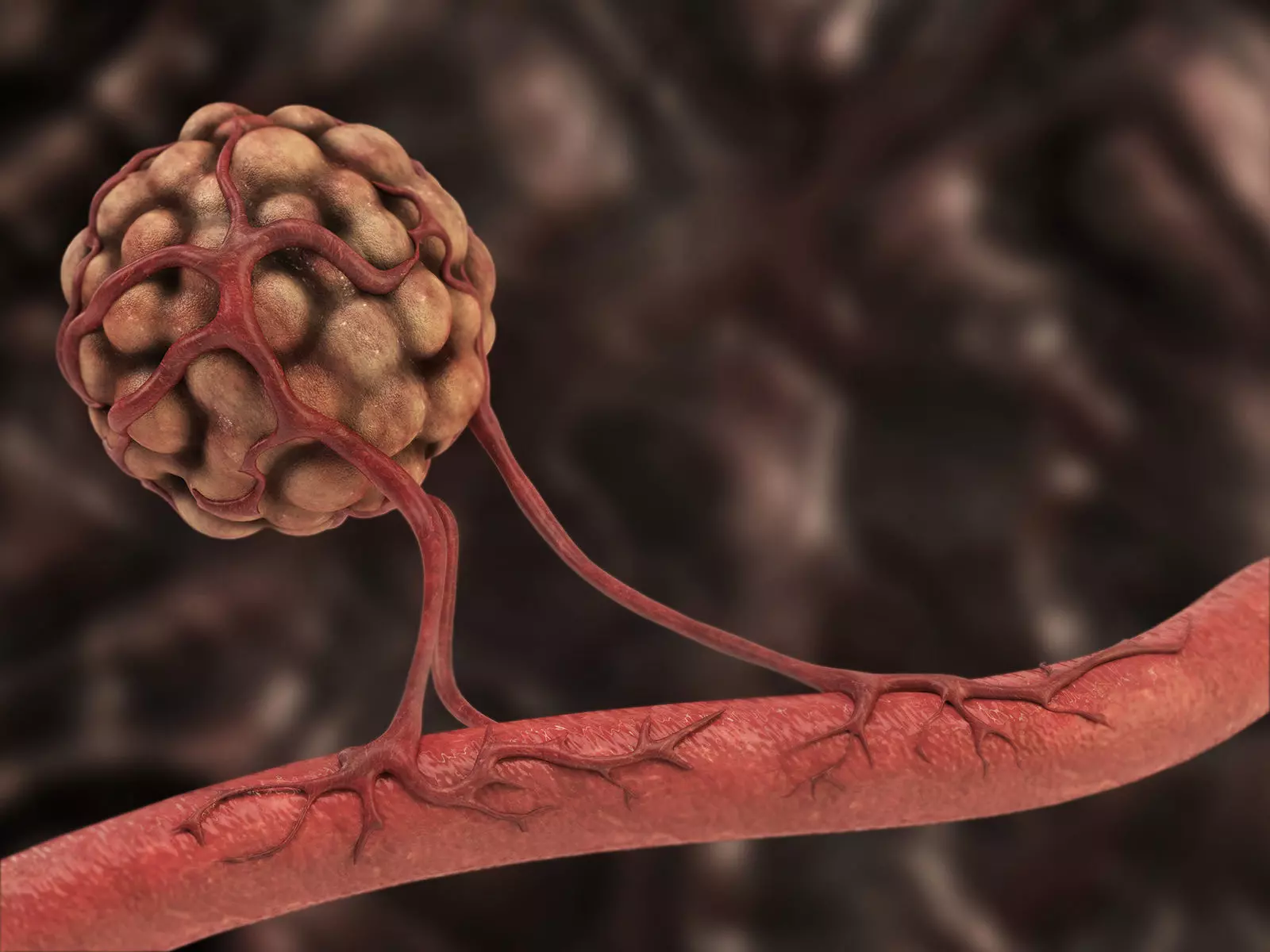 Angiogenesis stem with tumor 3D model
