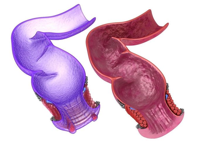 Human anatomy rectum and hemorrhoids  3D model