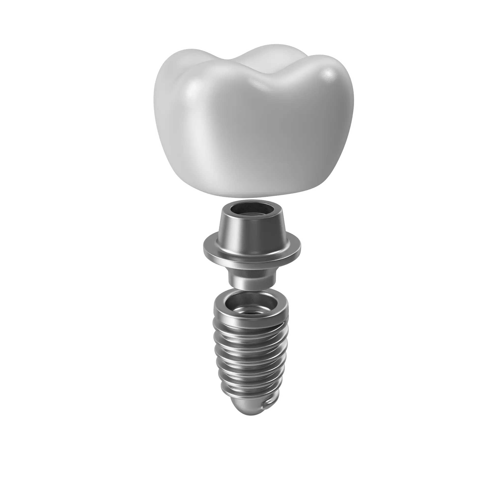 Tooth Implant 3D model