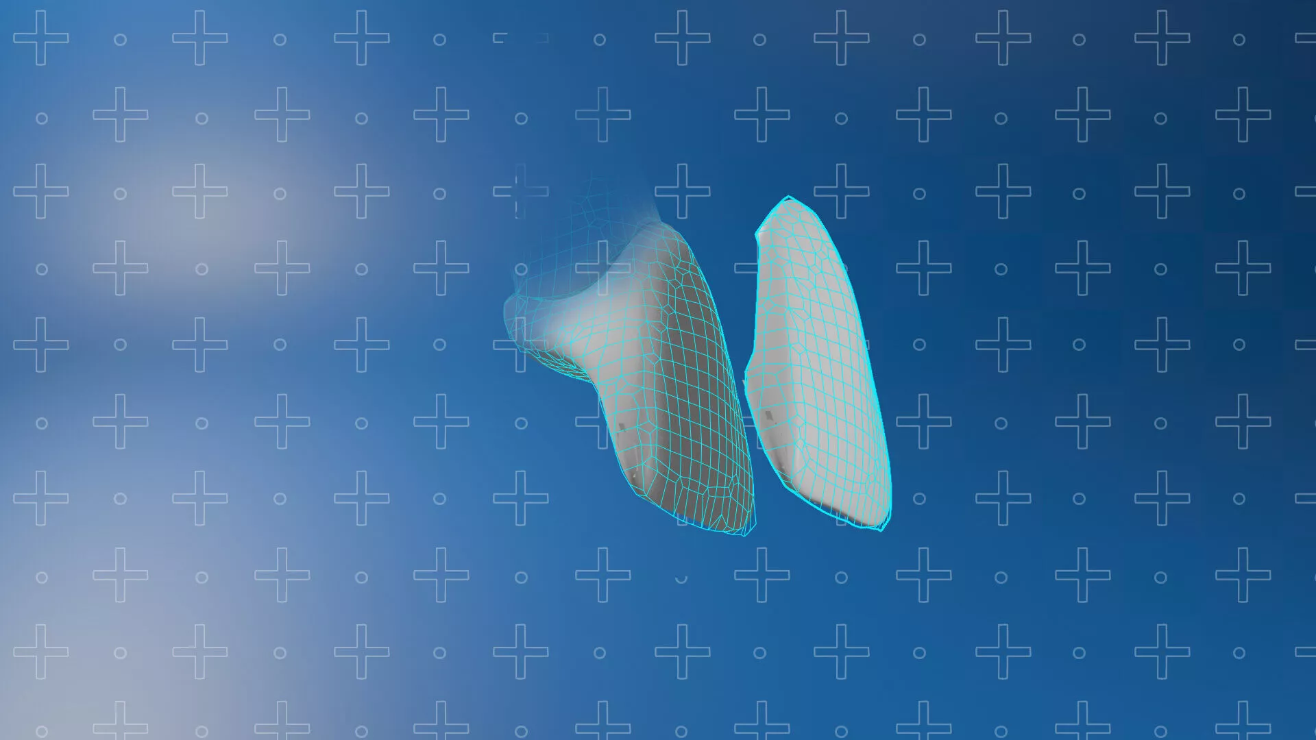 Dental Veneer Illustration Low-poly 3D model Low-poly 3D model