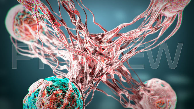 Cancer Static Hipoly Model 3D model