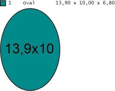 Ring aquamarine engagement 3D print model_5