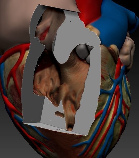 Medical model-Heart hollow-modeled 3D model_6