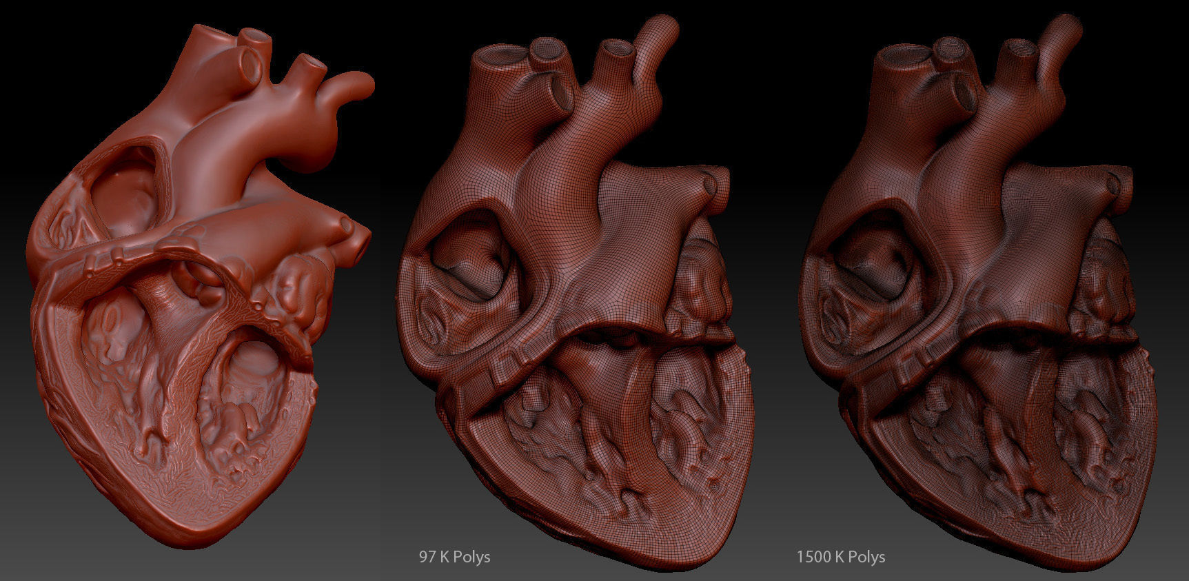 Medical model-Heart hollow-modeled 3D model_7