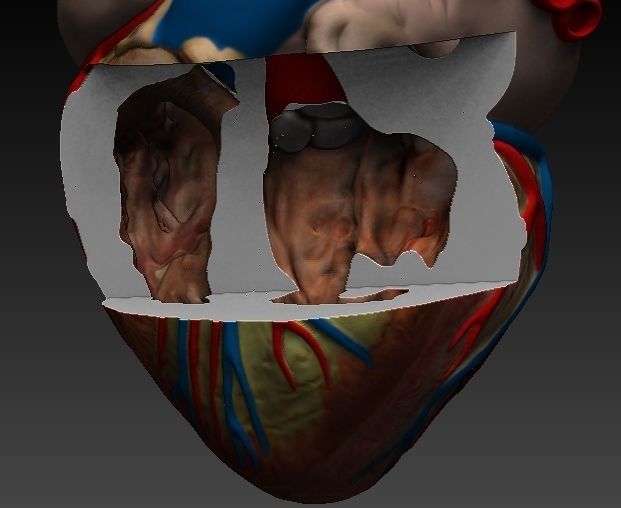 Medical model-Heart hollow-modeled 3D model_11