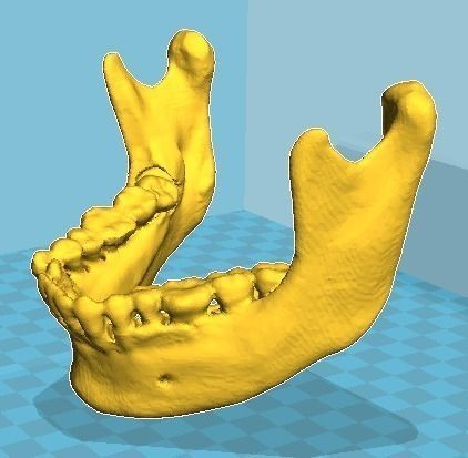 Lower Mandible Modeling 3D print model