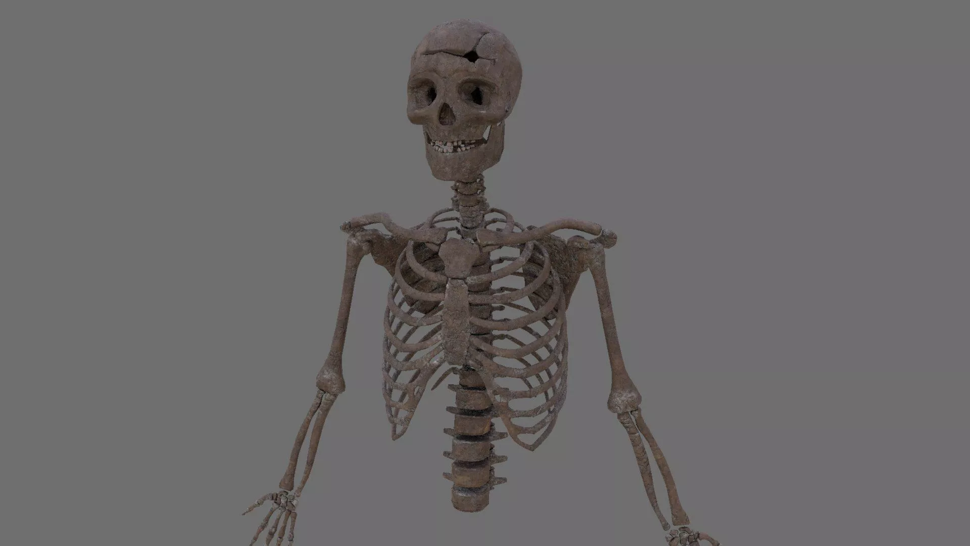 Skeleton Top Half with Bullet Hole in Head Free 3D model