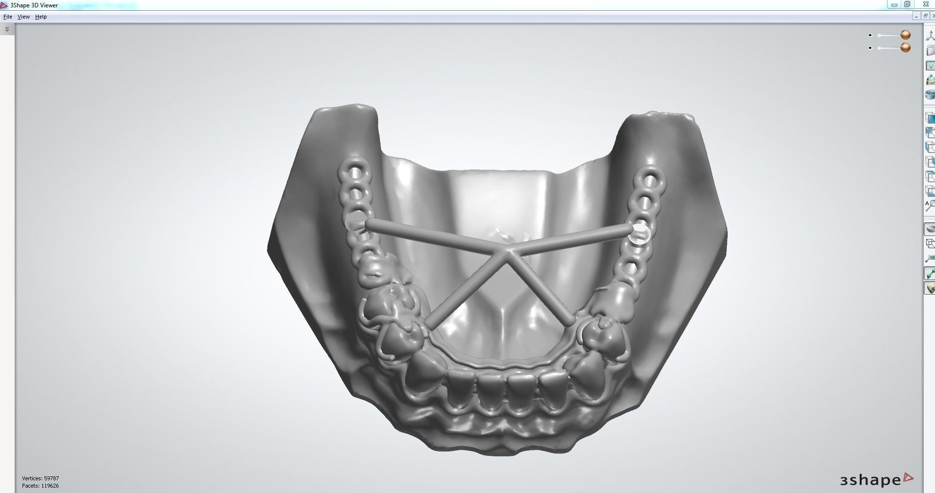 RPD Framework for SLM CNC and 3D Printing 3D print model_6