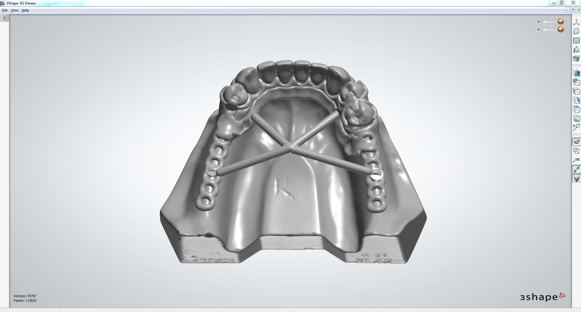RPD Framework for SLM CNC and 3D Printing 3D print model_9