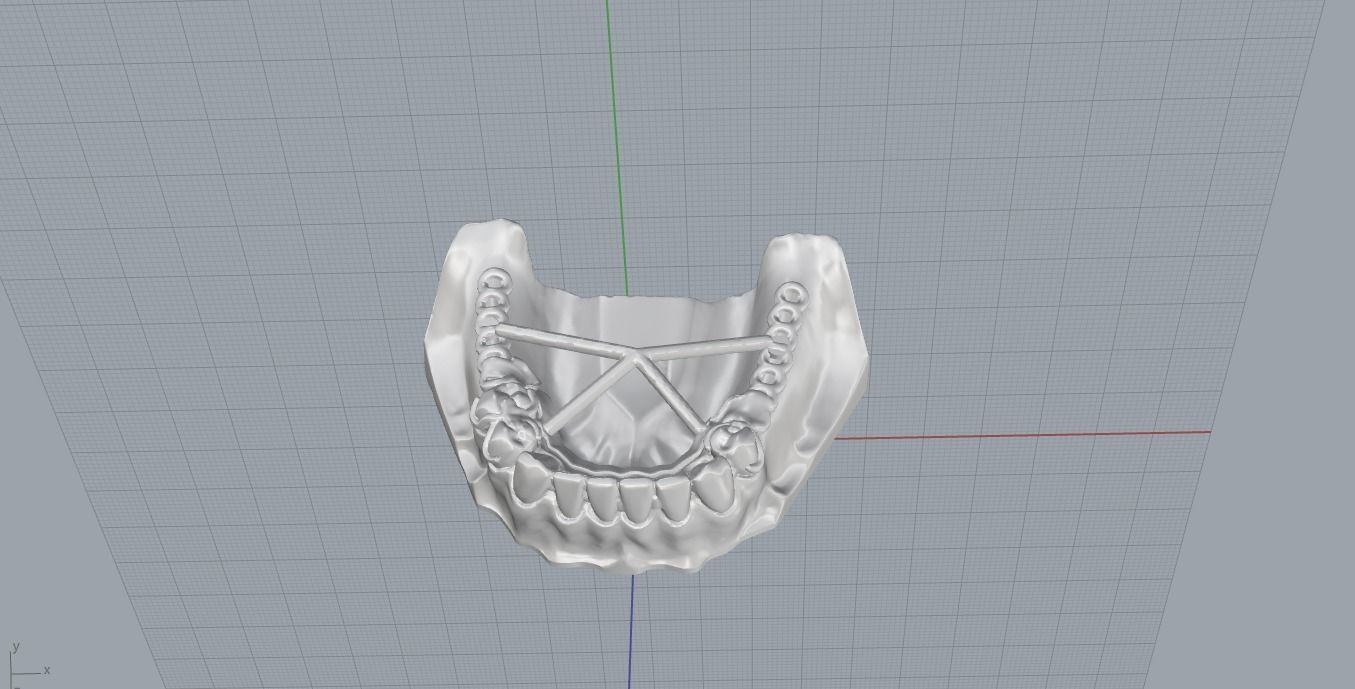 RPD Framework for SLM CNC and 3D Printing 3D print model_23