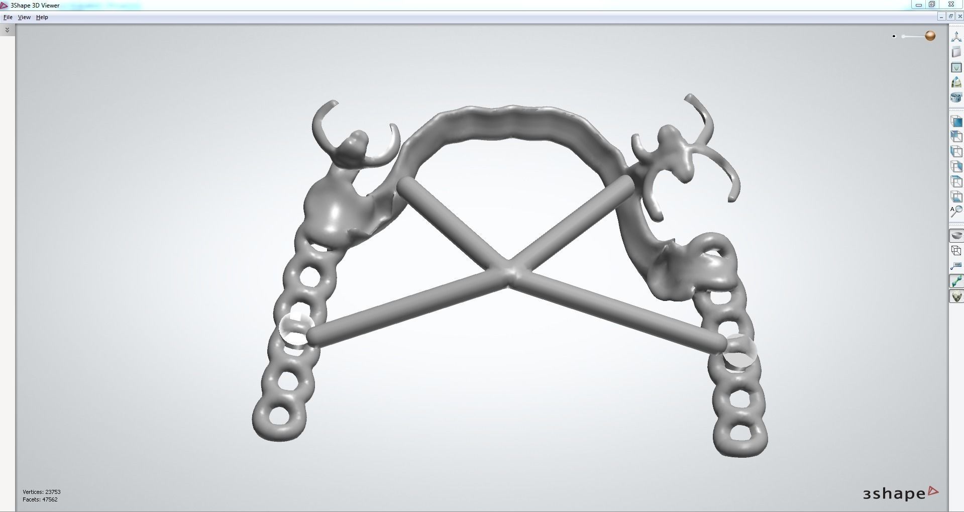 RPD Framework for SLM CNC and 3D Printing 3D print model_7