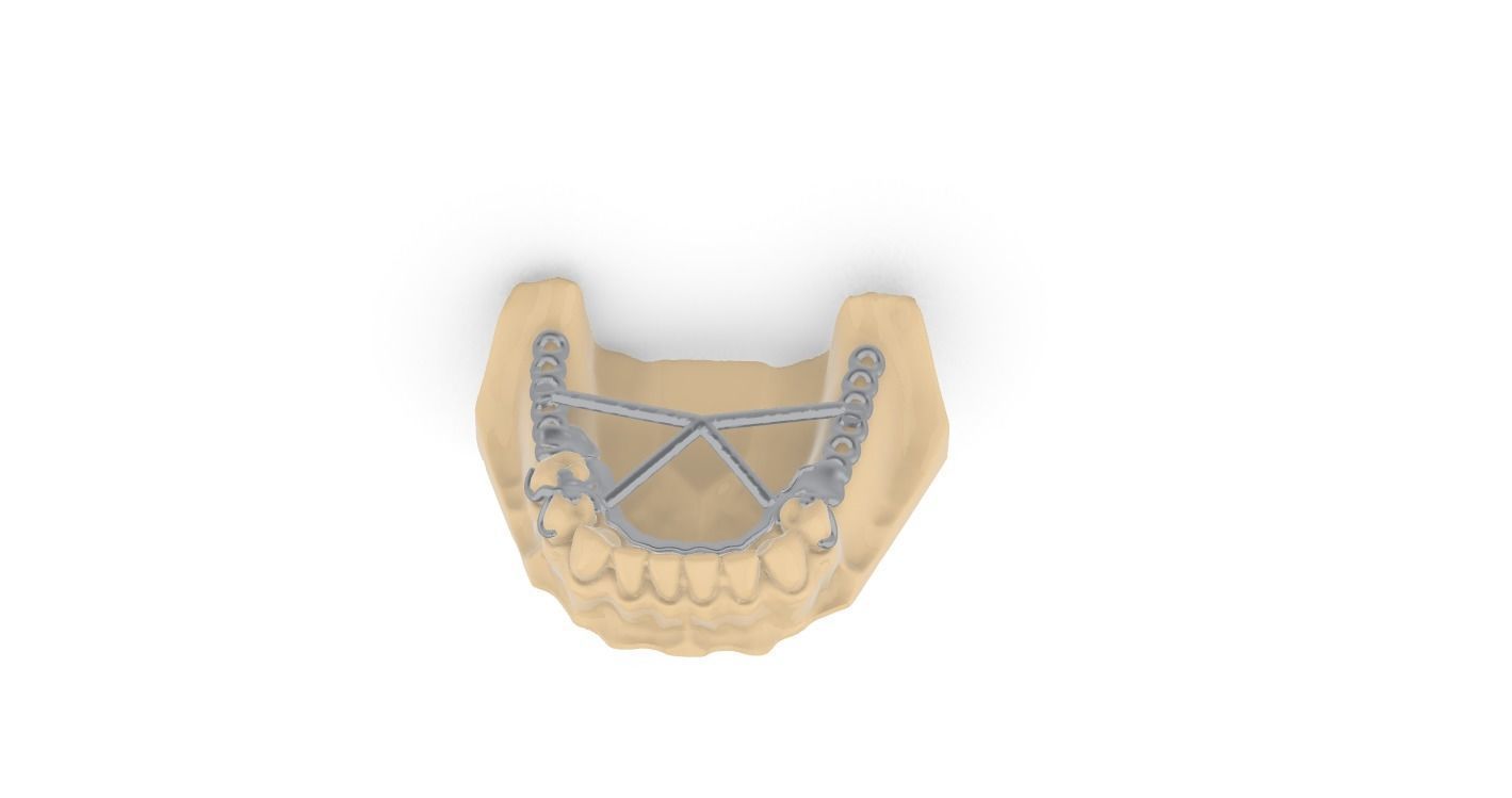 RPD Framework for SLM CNC and 3D Printing 3D print model_18
