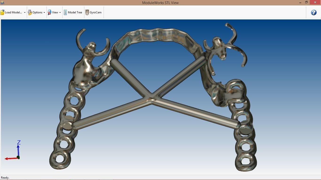 RPD Framework for SLM CNC and 3D Printing 3D print model_13
