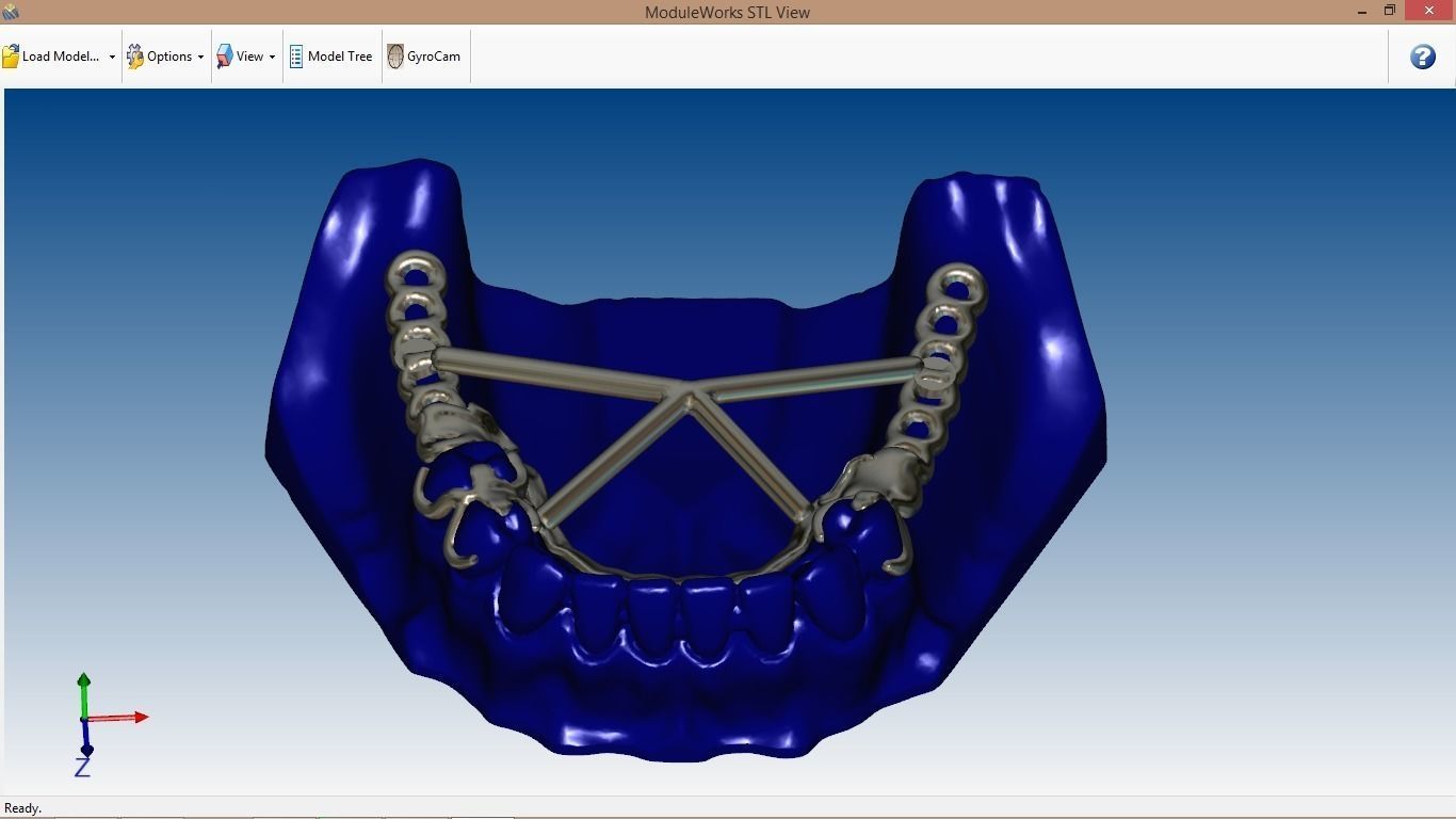 RPD Framework for SLM CNC and 3D Printing 3D print model_12