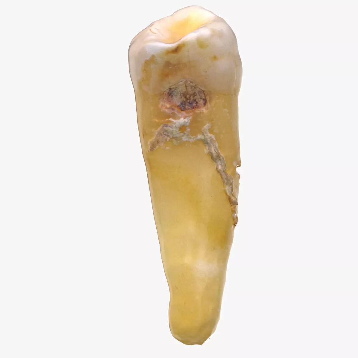 Premolar Lower Jaw 04 With Cavity 3D model