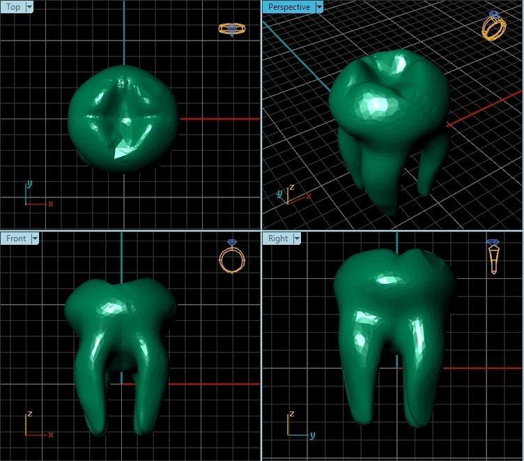 Pendant gold tooth charm 3D print model_2