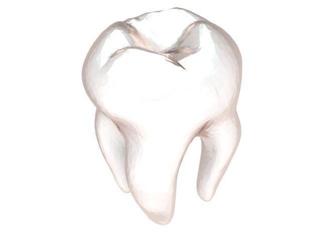 Pendant gold tooth charm 3D print model_1