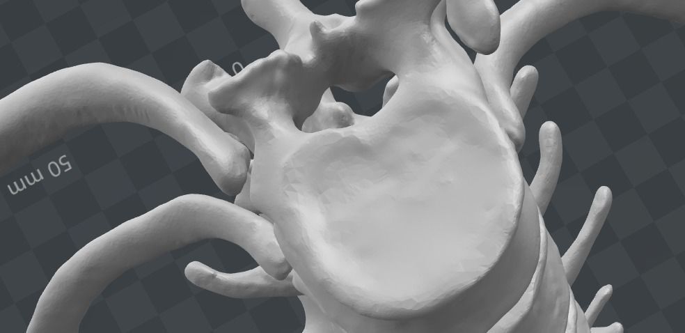 Vertebral column T11-L5   female - age 20 3D model_9