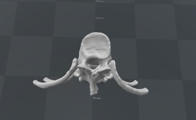 Vertebral column T11-L5   female - age 20 3D model_3