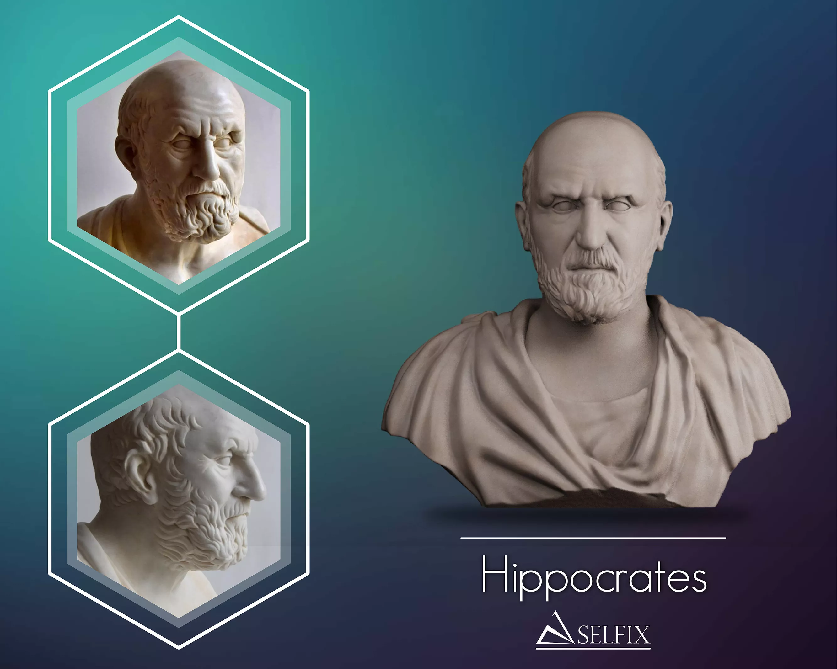 Hippocrates Bust Sculpture 3D print model