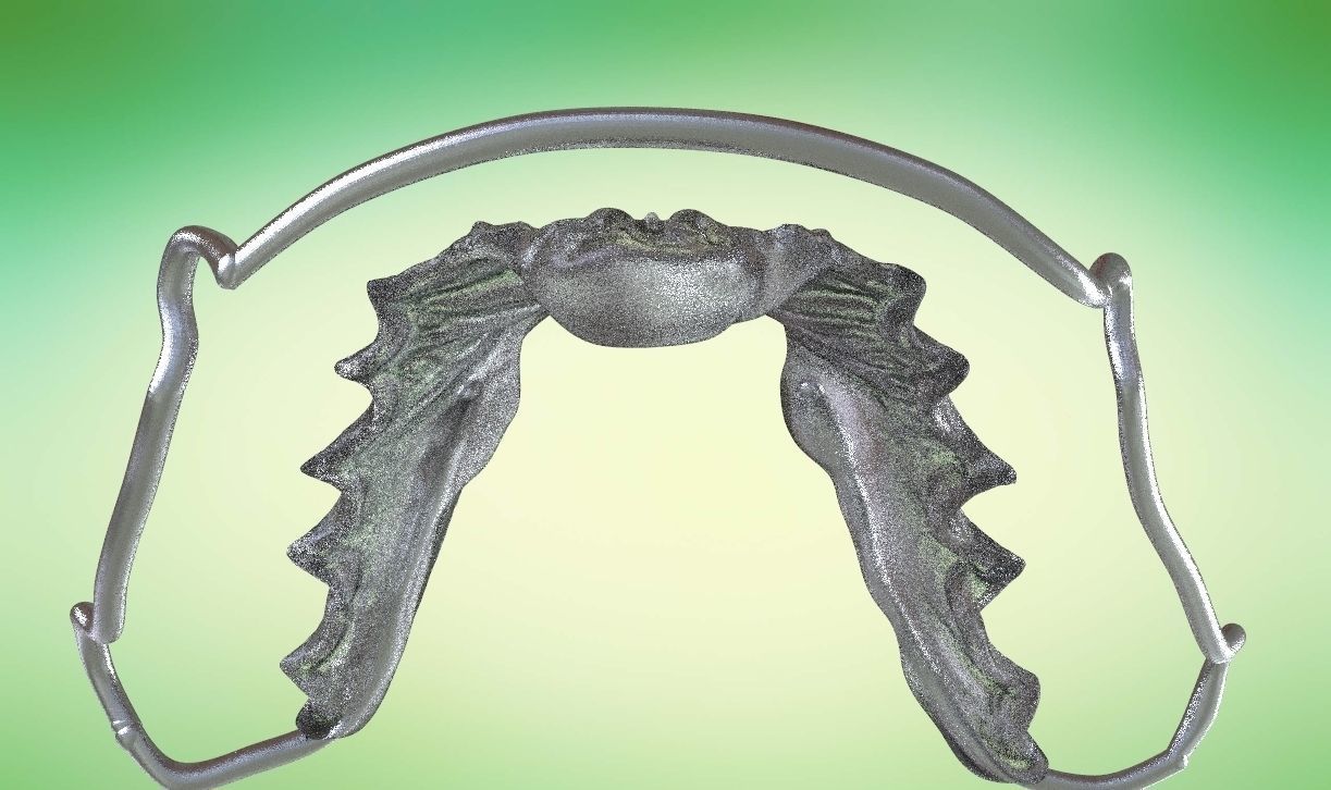 Digital Kois Deprogrammer Appliance 3D print model_7