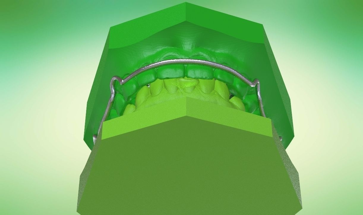 Digital Kois Deprogrammer Appliance 3D print model_18