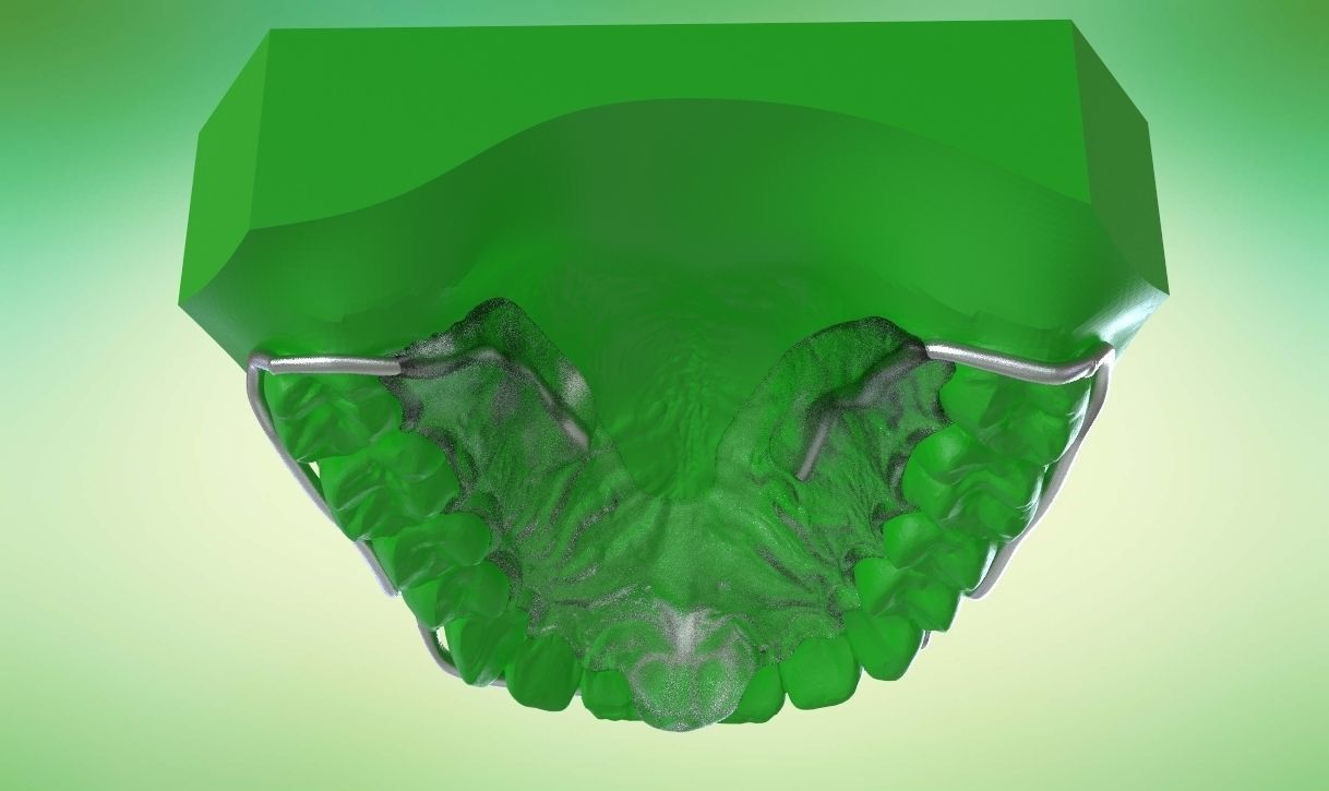 Digital Kois Deprogrammer Appliance 3D print model_3