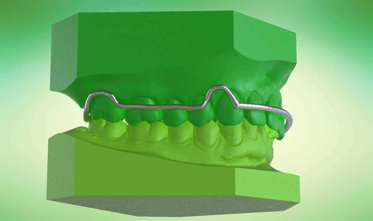 Digital Kois Deprogrammer Appliance 3D print model_14