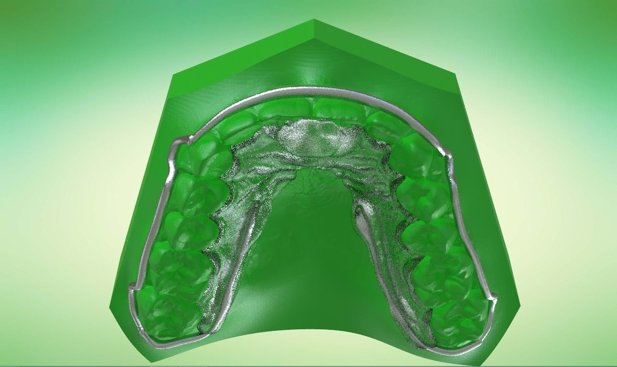 Digital Kois Deprogrammer Appliance 3D print model_4