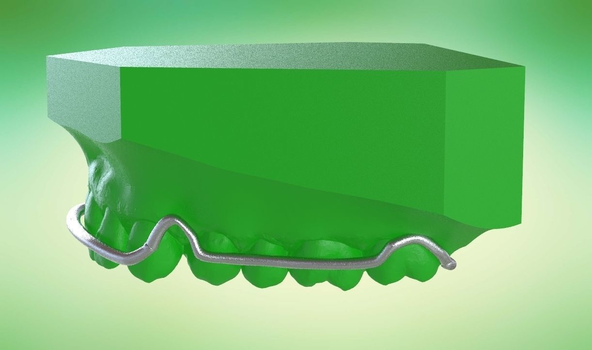 Digital Kois Deprogrammer Appliance 3D print model_5