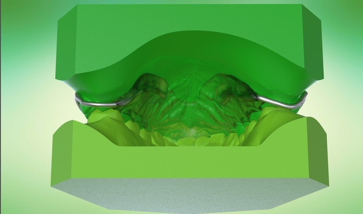 Digital Kois Deprogrammer Appliance 3D print model_16